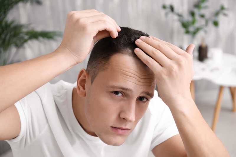 Alopécie et chute de cheveux : homme, femme, tous égaux ?